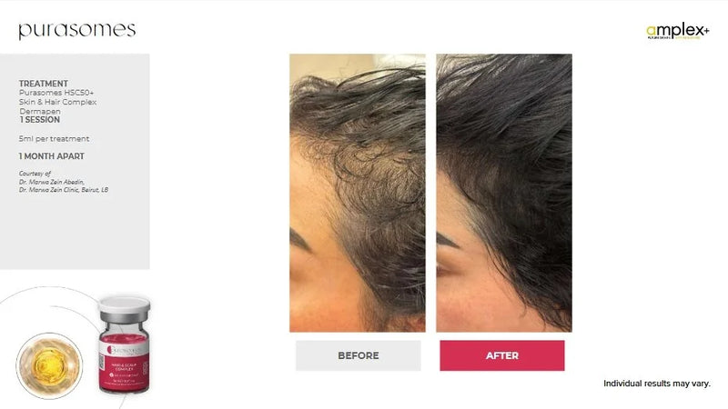 THE DERMA VITAL STANDARD